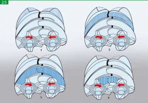 無油螺桿空壓機和噴油螺